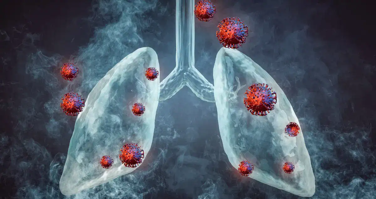 How Is Lung Cancer Diagnosed