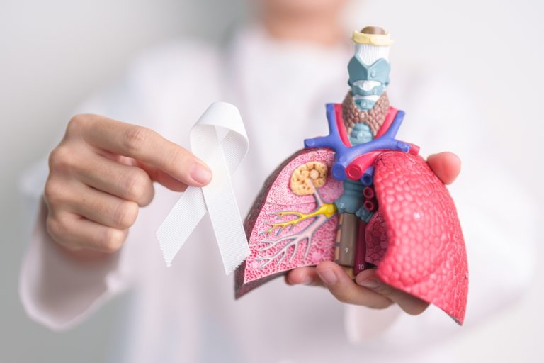 medical professional holding a model of the lungs for lung cancer pathology education