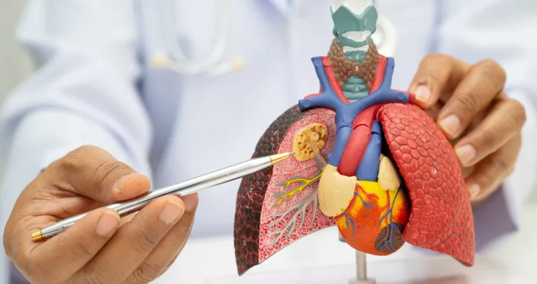 How Is Lung Cancer Diagnosed