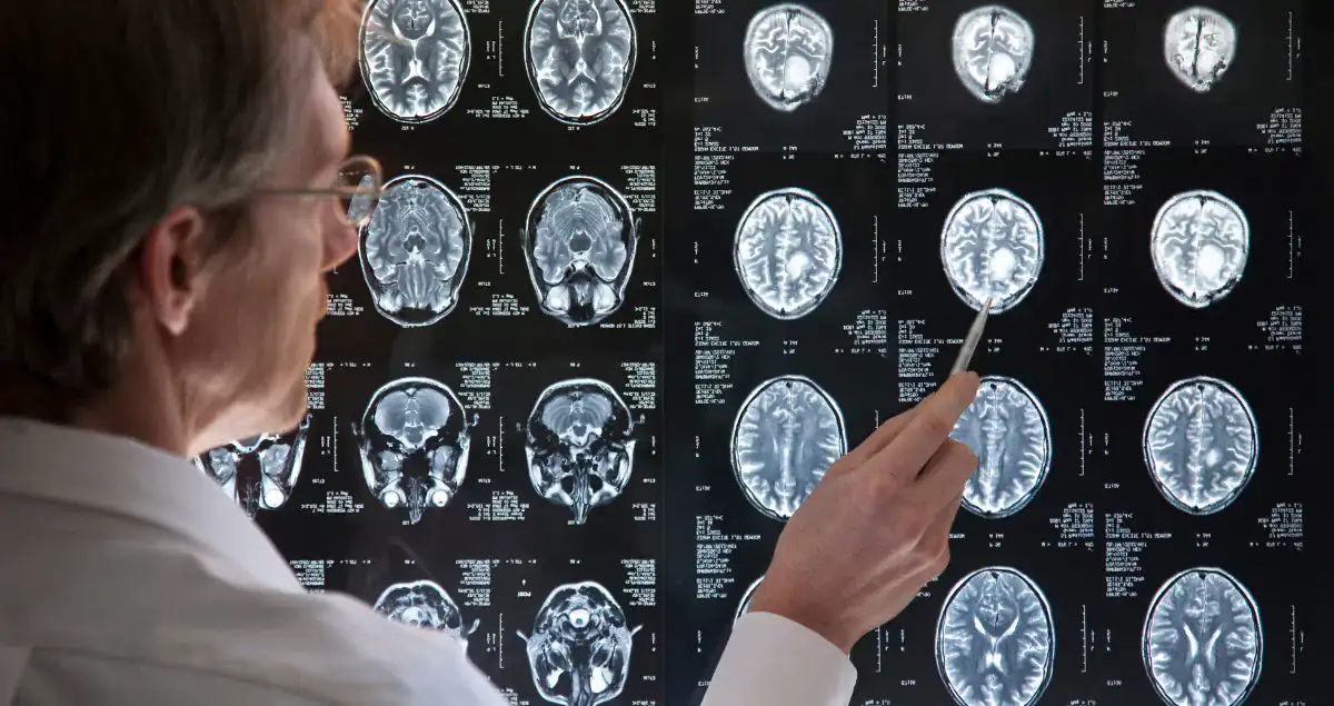 What are tumor grades and what do they mean