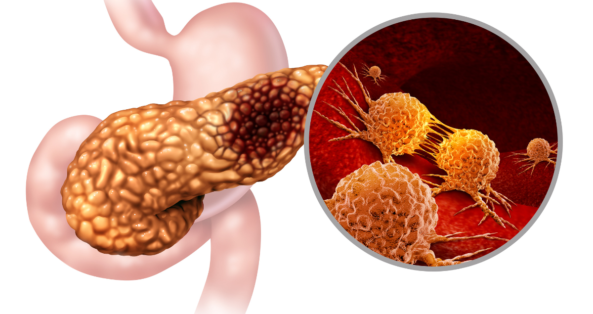 What do liver biopsy results mean