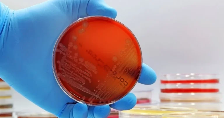 How Pathologists Detect Infections in Tissue Samples