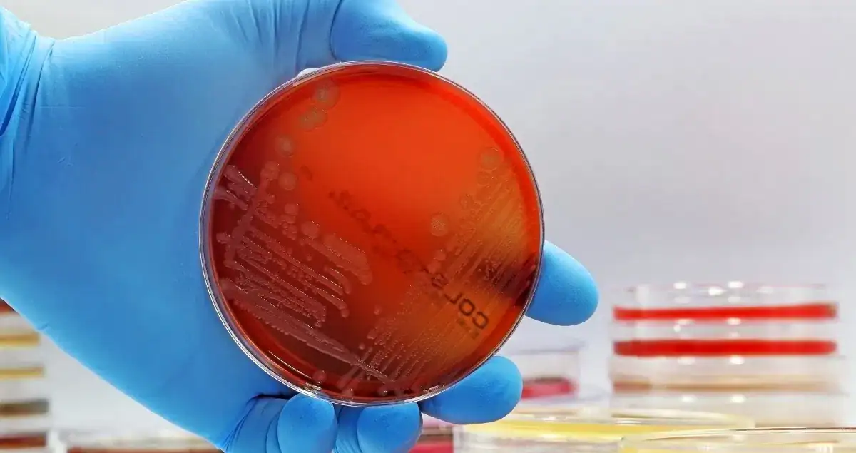How Pathologists Detect Infections in Tissue Samples