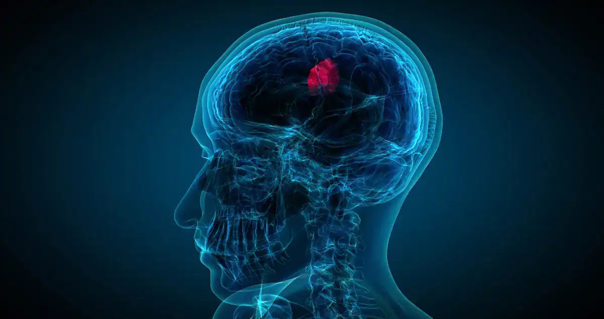 Structure of a Benign Tumor Pathology Report