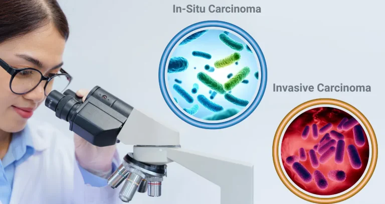 Understanding the Difference Between In-Situ and Invasive Carcinoma