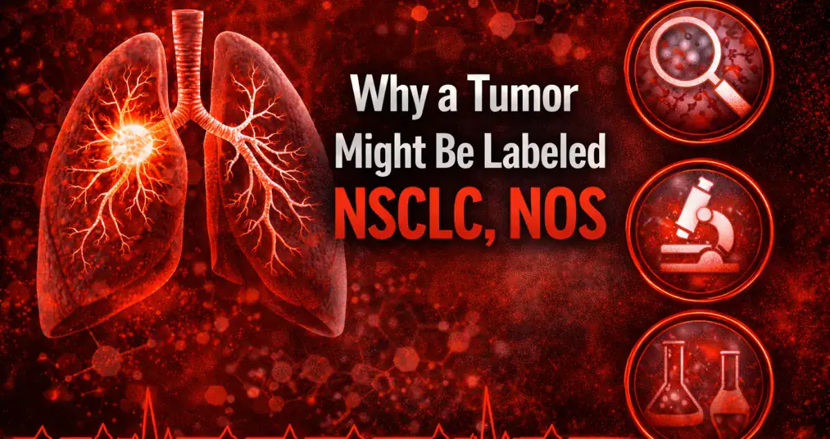 Why a Tumor Might Be Labeled NSCLC, NOS