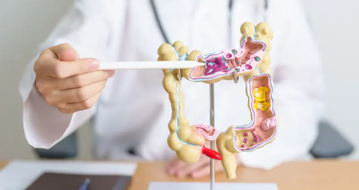 Recurrence of Tubular Adenomas