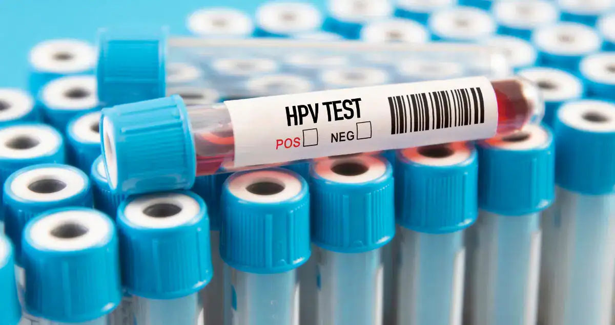 Why does HPV status matter in pathology?