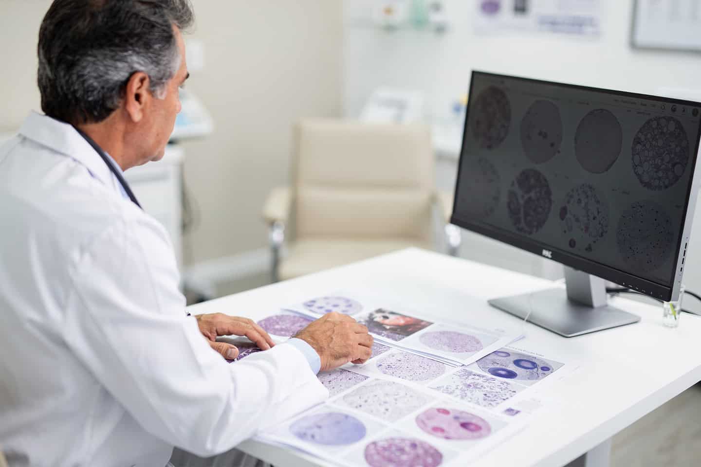 Doctor reviewing records for a Pathology slides second opinion consultation.
