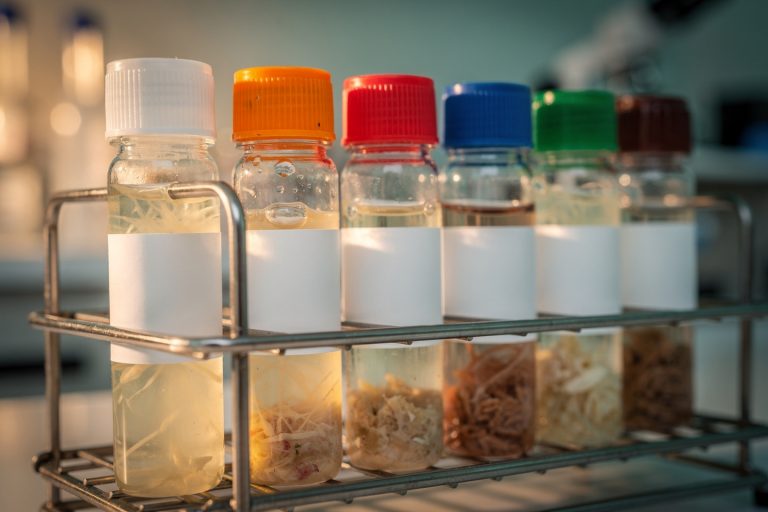 Close-up of labeled specimen vials representing how to read a cancer pathology report step by step