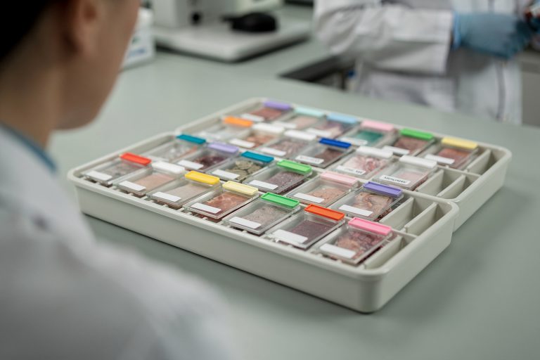Close-up of a labeled pathology slide tray for a guide on what to do if you don’t understand your pathology results.