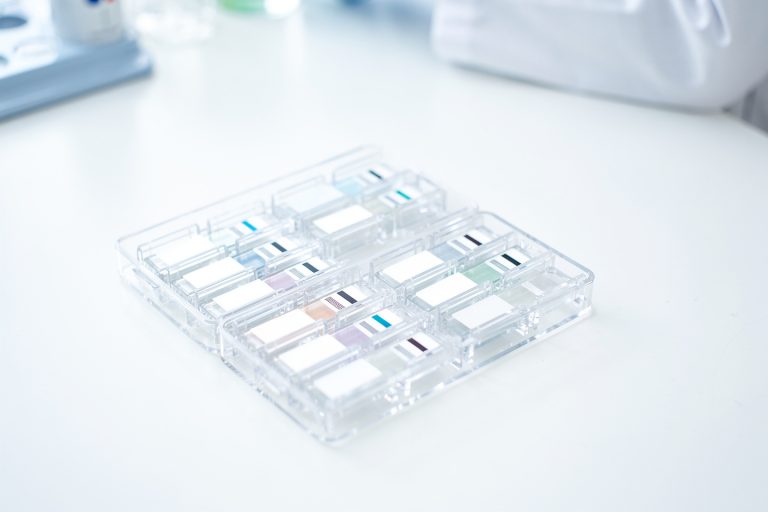 Close-up of a pathology slide tray representing how to get a second opinion on your pathology report