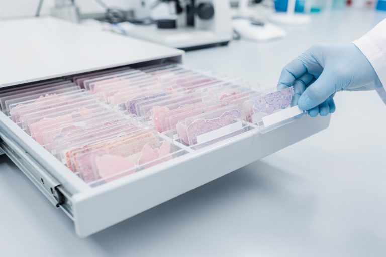 Close-up of a labeled pathology slide tray representing how to choose the right expert for a pathology consultation.