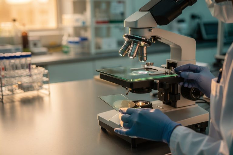 Pathology slides being reviewed for a pathology report second opinion by a qualified specialist.